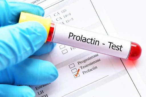 prolactina